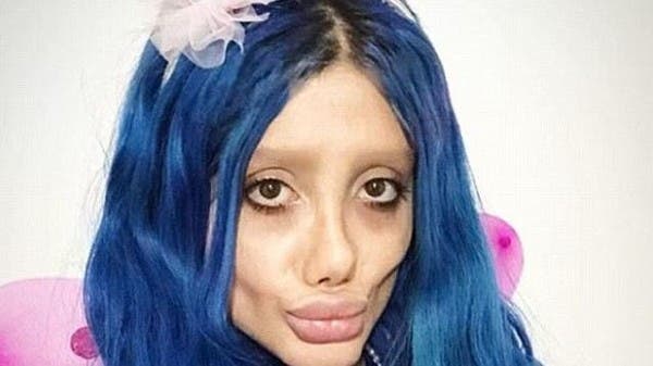 بعد ظهور صاعق.. أنجلينا جولي إيران تكشف سر وجه “الزومبي”