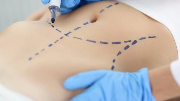 نزفت 8 ساعات.. شفط دهون بمركز تجميل يهز الأردن