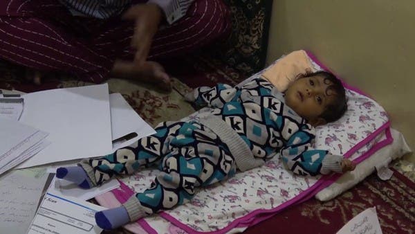دخلت المستشفى للعلاج فخرجت كفيفة.. الطفلة سدرة آخر ضحايا الأخطاء الطبية في تعز