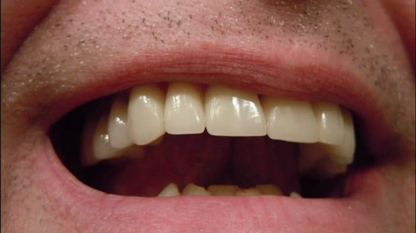 تحذير خطير.. حافظ على نظافة الفم وسارع بعلاج أي خراج بالأسنان!