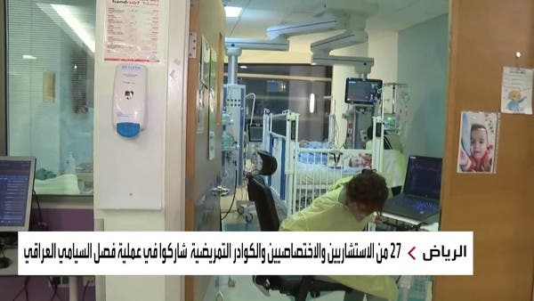 نجاح عملية فصل التوأم السيامي العراقي “علي وعمر”