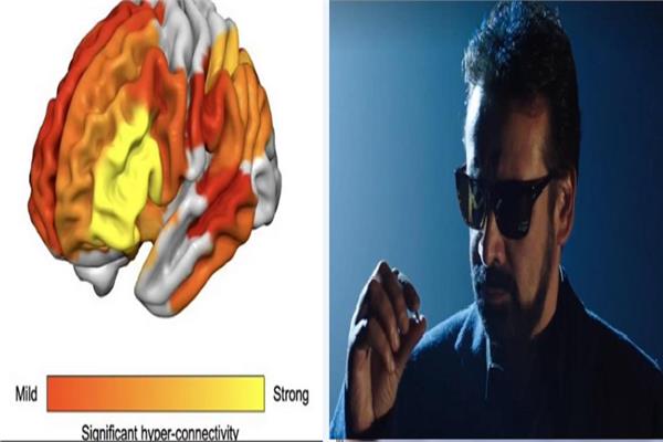 علماء يكشفون أسرار مادة “DMT” بطلة “الفيل الأزرق”