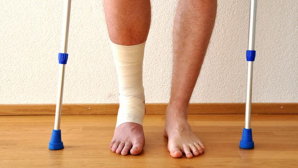 تبريد أنسجة العظام يسرع الشفاء من الكسور!