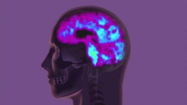 إطلاق الضوء الأخضر لتجربة زراعة شريحة إلكترونية في الدماغ البشري