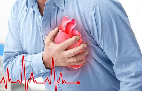 الذكاء الاصطناعي يميّز بين خمسة أنواع فرعية من نوبات القلب