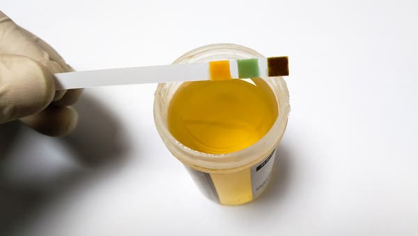 في المنزل.. اختبار بسيط يكشف عن مرض “فقدان العضلات”