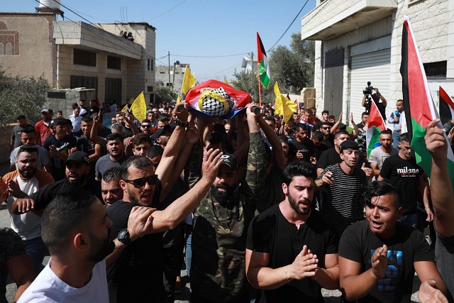 استئصال عين طفل بعد إصابته برصاص الاحتلال شمال غرب نابلس-الحياة الجديدة