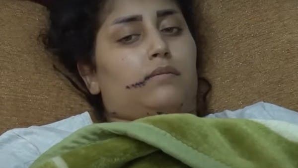 عراها من ملابسها وسط الشارع.. عراقي يطعن طليقته 31 مرة