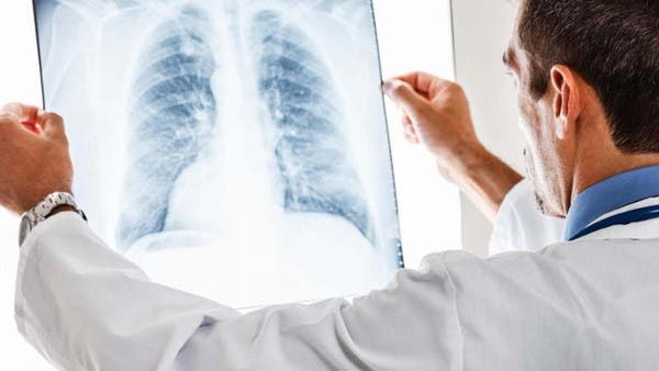 انتبهوا.. أعراض سهلة الملاحظة تنذر بسرطان الرئة