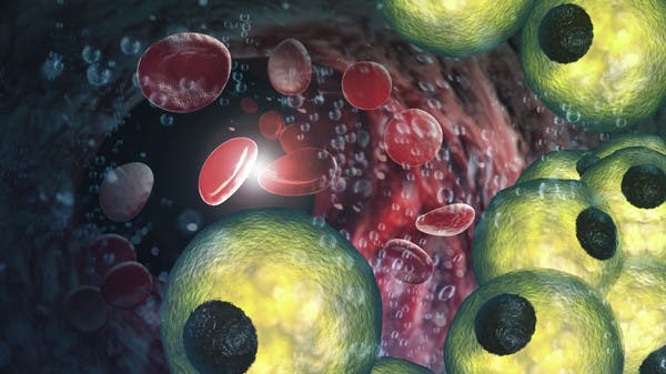 خبر سار.. اكتشاف قد يؤدي لعلاج رواسب الدهون في الشرايين