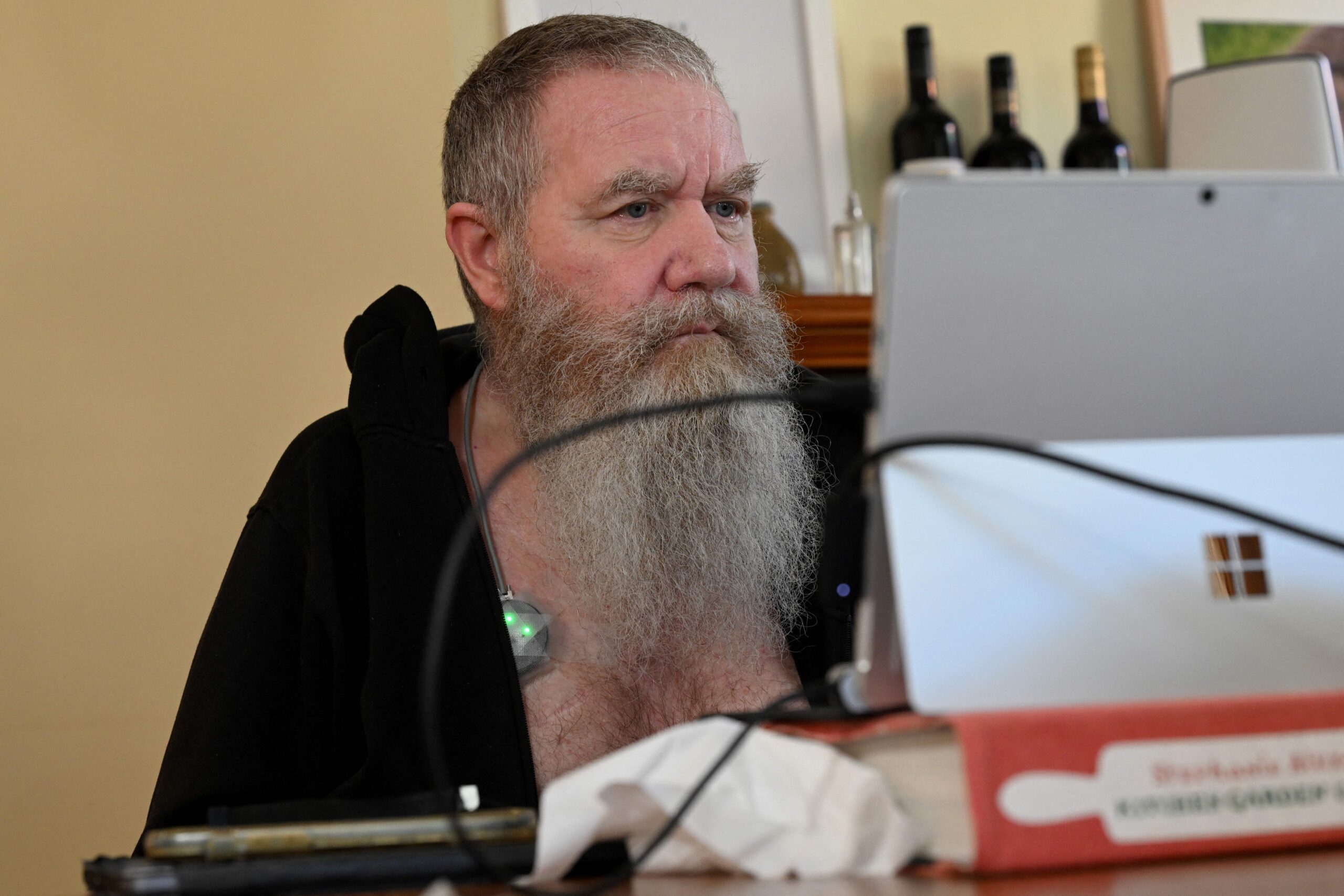 متطوع أسترالي يلعب دوراً حاسماً في تطوير غرسات التواصل بين الدماغ والآلات