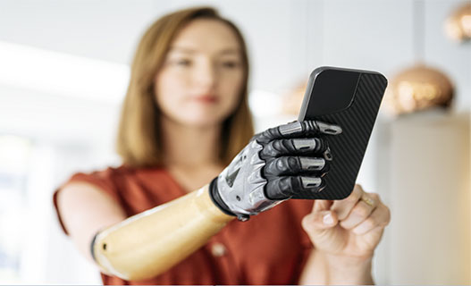 يد إلكترونية تندمج مع العظام والأعصاب