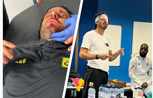 اعتداء جماهير مارسيليا على حافلة ليون يلغي لقاء الفريقين في الدوري