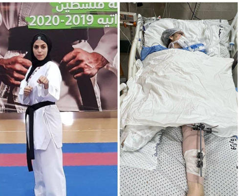 نغم أبو سمرة.. بطلة كاراتيه بلا ساق نتيجة عدوان الاحتلال