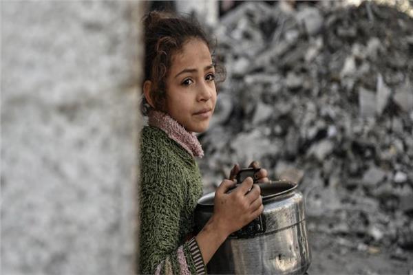 وفاة طفلة نتيجة سوء التغذية في غزة