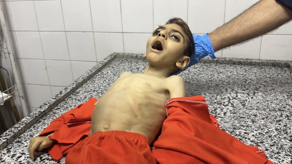 21 طفلا توفوا بسبب سوء التغذية والمجاعة في قطاع غزة-الحياة الجديدة