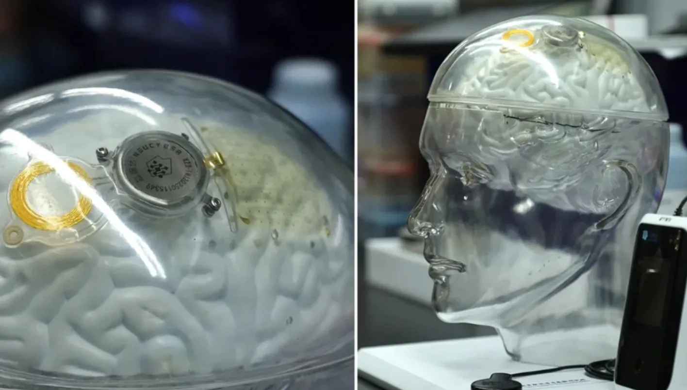 الصين تدخل سباق ‘تكنولوجيا الدماغ’ بقوة: شريحة تنافس ‘نيورالينك’