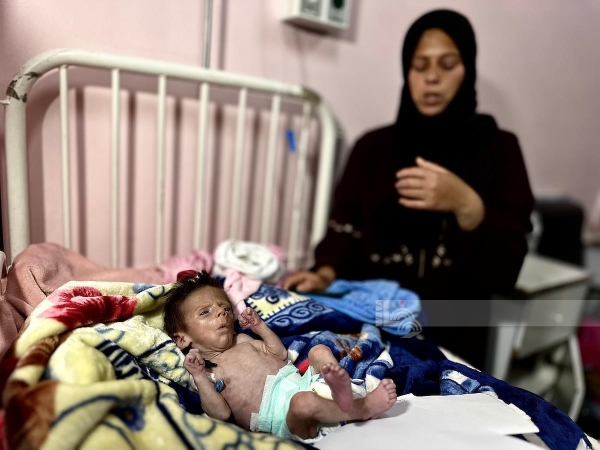 وفاة رضيع نتيجة سوء التغذية في غزة-الحياة الجديدة