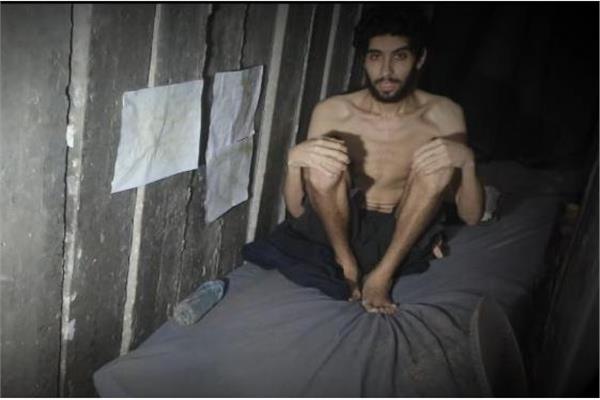 «يأكلون مما نأكل».. كتائب القسام تنشر فيديو لمحتجز إسرائيلي يعاني من سوء التغذية