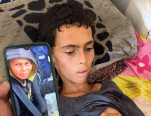 وفاة فتى بسبب سوء التغذية والمجاعة في غزة-الحياة الجديدة