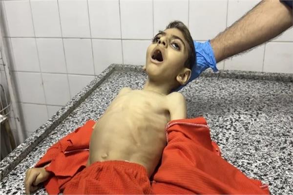 الأمم المتحدة: 96% من الأسر في غزة تواجه انعدام الأمن المائي