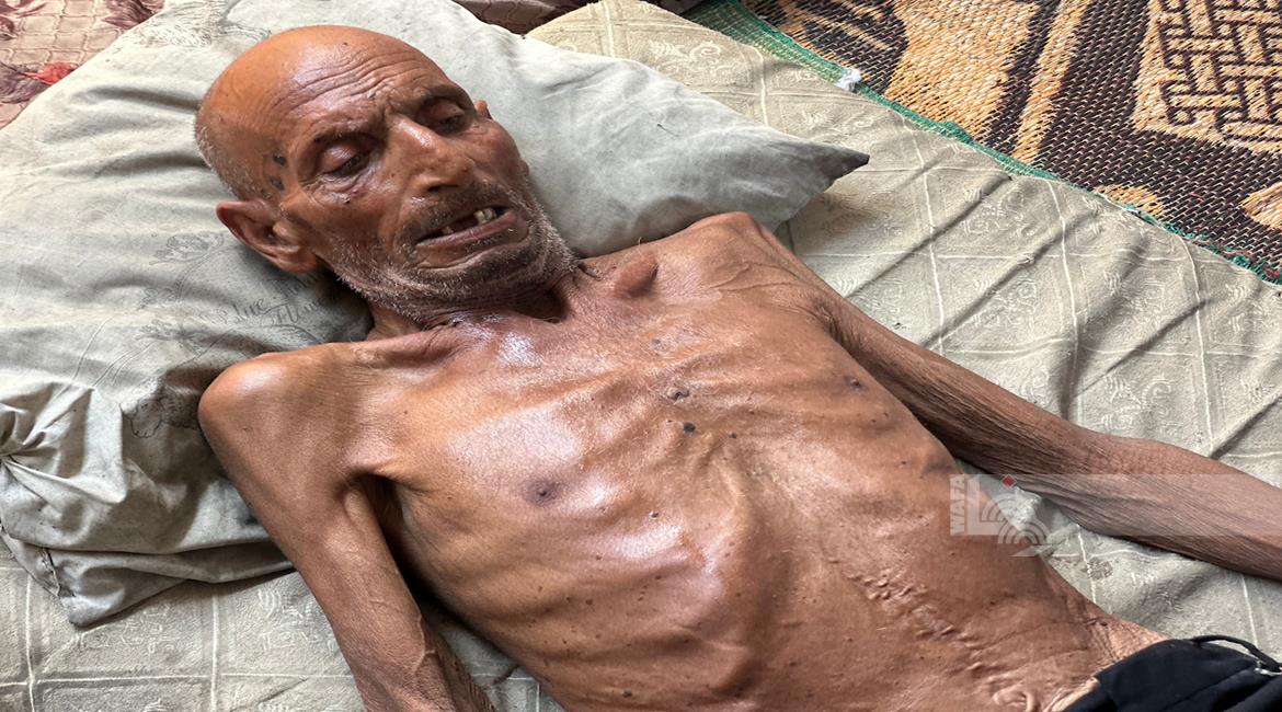 8 وفيات نتيجة المجاعة وسوء التغذية خلال الـ24 ساعة الماضية-الحياة الجديدة