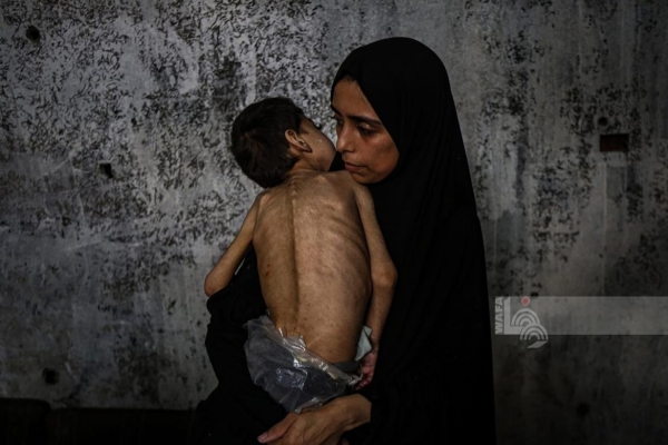 4 وفيات نتيجة المجاعة وسوء التغذية خلال الـ24 ساعة الماضية في قطاع غزة-الحياة الجديدة