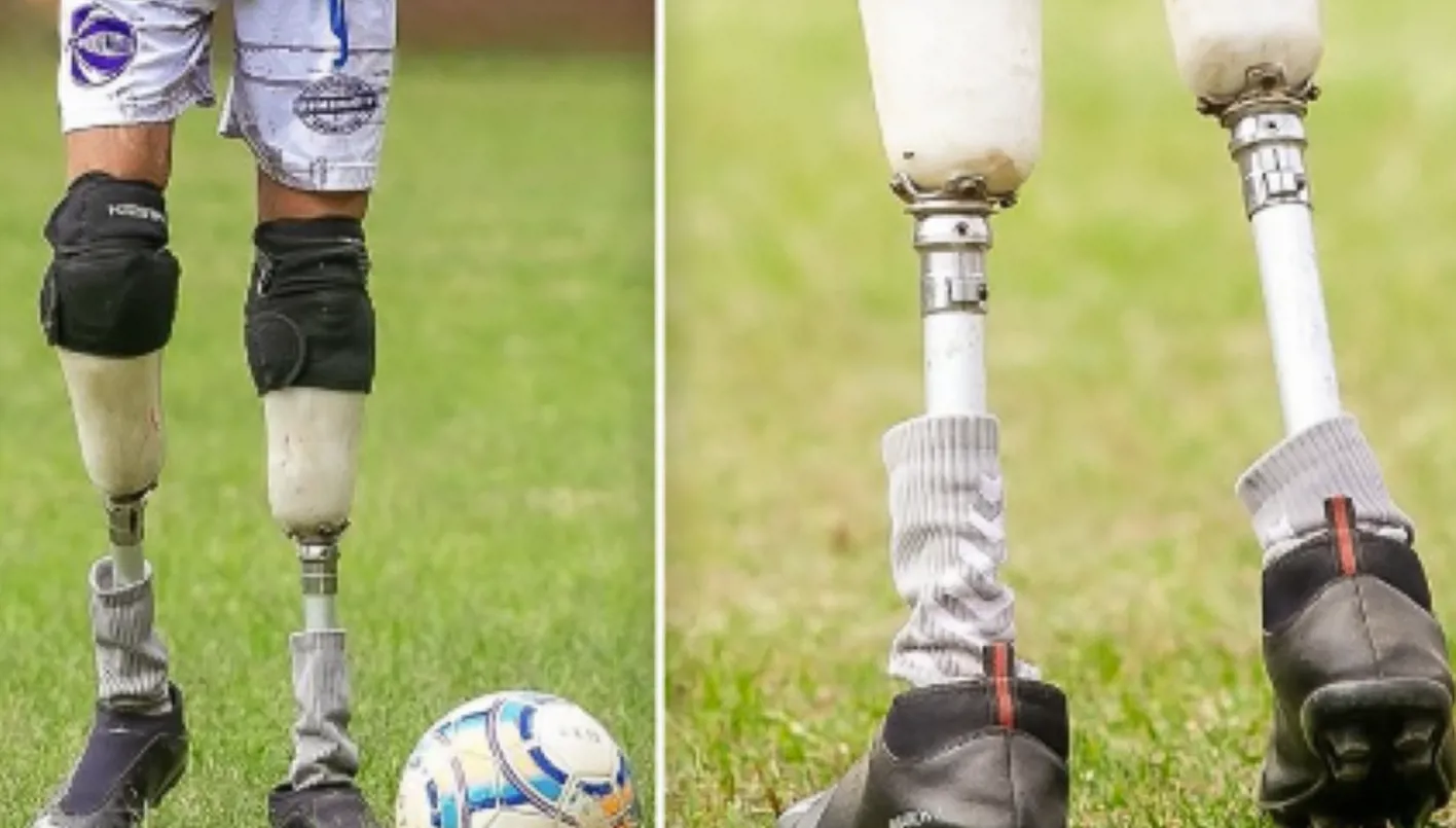 ولد من دون ساقين… قصة ولد يجب أن يراها العالم