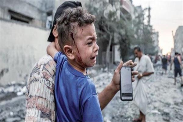 طبيب أمريكي متطوع بغزة: يجب توفير الحماية للأطفال وألا يكونوا جزءا من الحروب