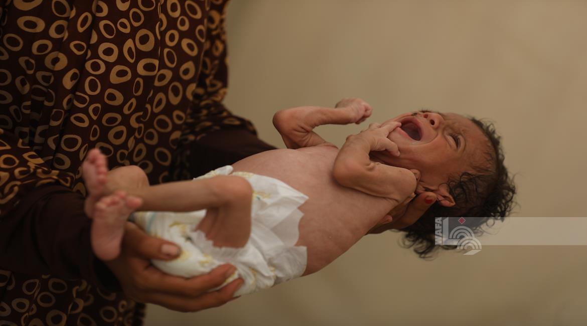 11 حالة وفاة نتيجة المجاعة وسوء التغذية خلال الساعات الـ24 الماضية-الحياة الجديدة