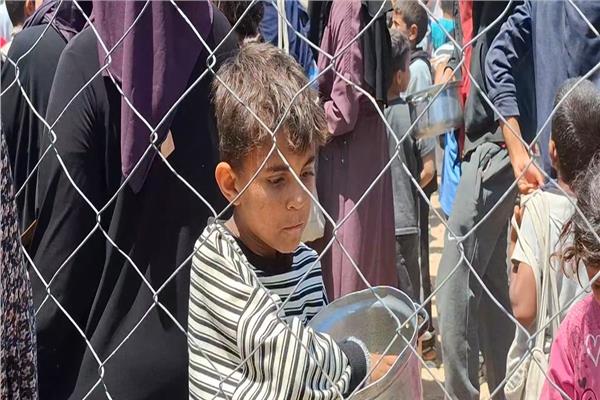 الأمم المتحدة: المستشفيات في غزة تكتظ بالمرضى وسبل النجاة من المجاعة منعدمة