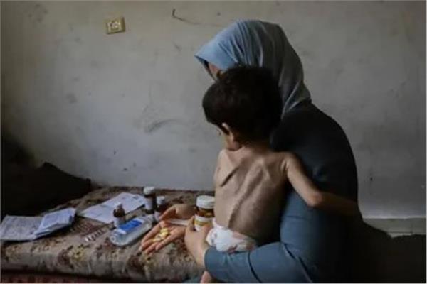 فلسطين: ارتفاع ضحايا المجاعة وسوء التغذية في غزة إلى 217 شهيدا بينهم 100 طفل