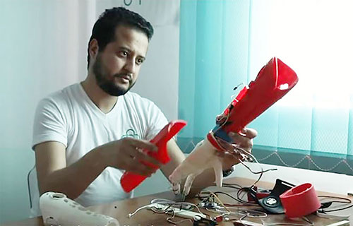 “هانيبال”.. أطراف صناعية تونسيّة تعمل بالذكاء الاصطناعي!