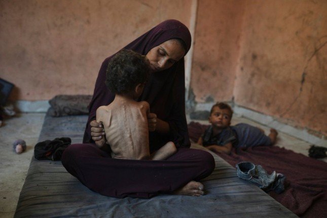 3 وفيات نتيجة المجاعة وسوء التغذية خلال الـ24 ساعة الماضية-الحياة الجديدة