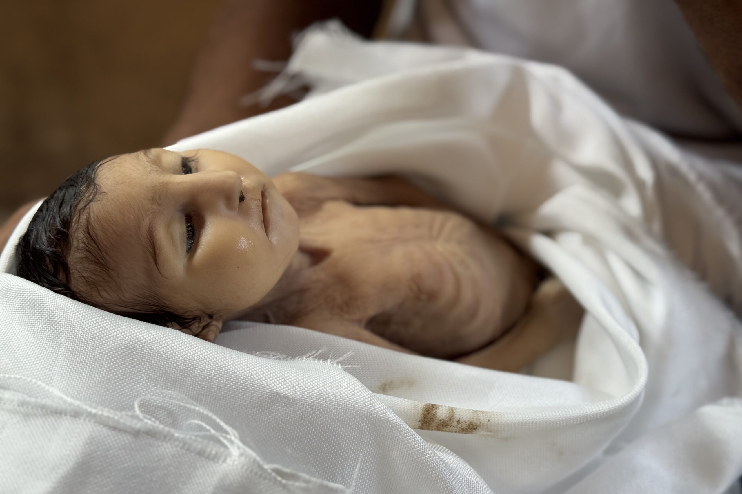 ضحية تجويع جديدة.. وفاة رضيعة جراء سوء التغذية في خان يونس-الحياة الجديدة