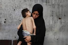 3 وفيات نتيجة المجاعة وسوء التغذية خلال الـ 24 ساعة الماضية-الحياة الجديدة