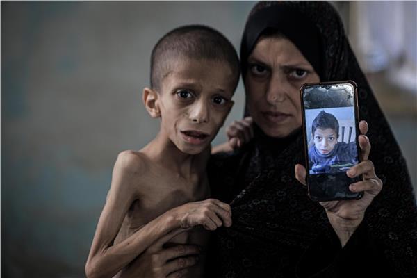 بريطانيا تلوح بالاعتراف بدولة فلسطين.. وتُعلن المجاعة في غزة