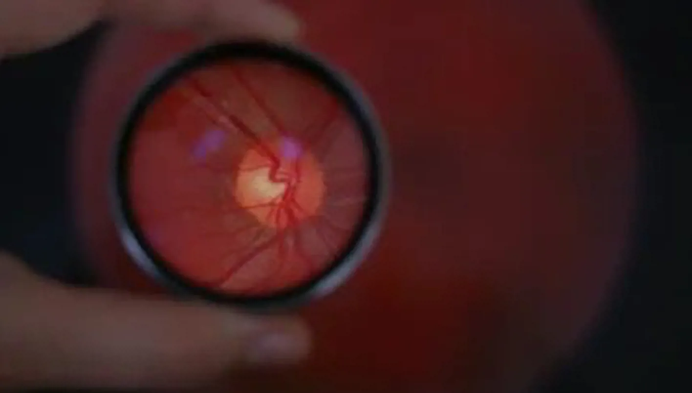 زراعة إلكترونية تعيد الأمل للمصابين بفقدان البصر